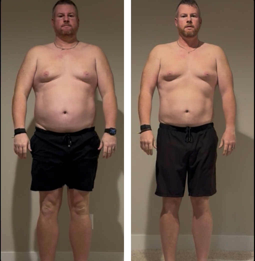 Dustin Frye, front view, day one and three months into the program